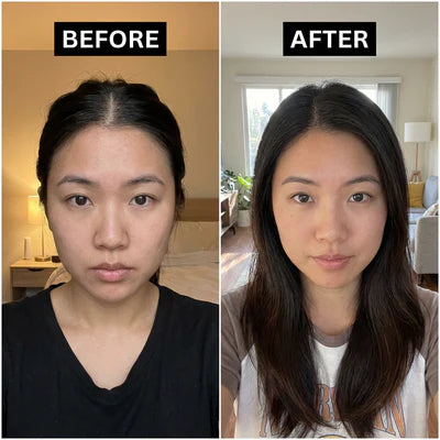 Before and after results using CuCure copper peptide hair care showing visibly thicker hair and reduced shedding